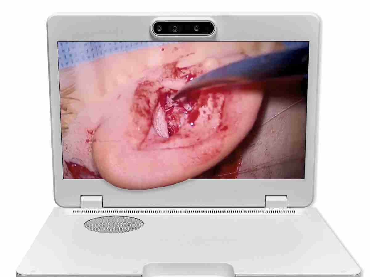 达擎之＂Heads-up 3D显微手术显示系统＂，，，，整合4K裸眼3D显示及眼球追踪系统，，，，具备快速追踪人眼移动位置功能，，，，减轻医师长时间维持固定姿势的负担，，，让医师能有更宽广清晰的3D立体视野及更舒适的姿势来执行手术。。。。